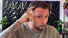 Rubén, de ‘LIDLT’, cuenta en tratamiento que ha seguido para solucionar sus problemas de caída de pelo