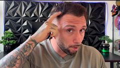 Rubén, de ‘LIDLT’, cuenta en tratamiento que ha seguido para solucionar sus problemas de caída de pelo