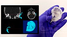 Así son algunas de las empresas que forman parte de Próspera: impresión de órganos, implantes subcutáneos o el mayor banco biológico