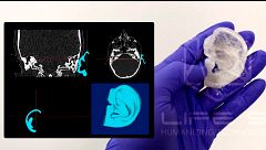 Así son algunas de las empresas que forman parte de Próspera: impresión de órganos, implantes subcutáneos o el mayor banco biológico