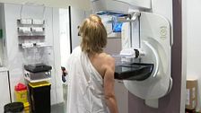 El Hospital Reina Sofía de Córdoba consigue detectar el cáncer de mama cinco años antes con la IA: "Puede evitar que aparezca"