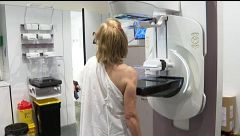 El Hospital Reina Sofía de Córdoba consigue detectar el cáncer de mama cinco años antes con la IA: "Puede evitar que aparezca"