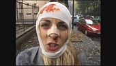 DI CIOCCIO: Lo stregone del Botulino