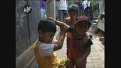 PELLIZZARI: Bambini malati di AIDS in Perù