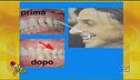 I denti dei Vip