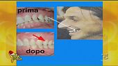 I denti dei Vip