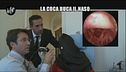 VIVIANI: Lesioni da cocaina