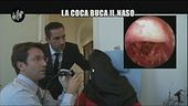 VIVIANI: Lesioni da cocaina