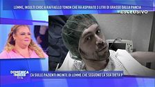 Raffaello Tonon e l'intervento di liposcultura