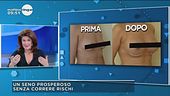 Un seno prosperoso