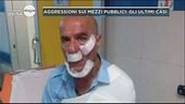 Aggressioni sui mezzi pubblici in Italia