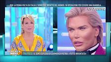 Rodrigo Alves, l'uomo che ha scelto di essere Ken