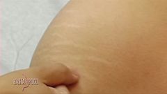 Prendersi cura della nostra pelle