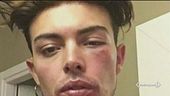 Difende una ragazza, picchiato