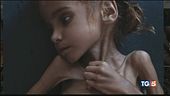 Amal è morta di fame in una guerra dimenticata