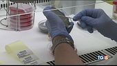 Epidemia di morbillo