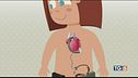 Mini-cuore artificiale salva bimba di 3 anni