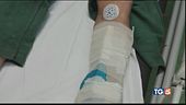 Chiamatela emergenza ingessati col cartone