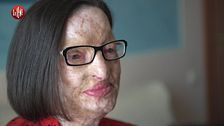 NINA: Sfregiata dall'acido, il coraggio di Filomena