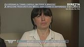 L'amputazione di un braccio