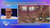I gioielli dentali