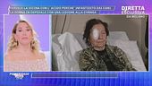 Mariagrazia: "Il mio vicino mi ha gettato l'acido in faccia"