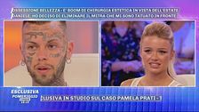 Daniele Di Bella e la rimozione dei tatuaggi