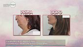 I consigli per il ringiovanimento del viso