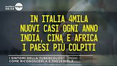 I sintomi della tubercolosi