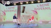 L'acne giovanile