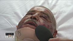 Lanciano, la testimonianza del dottore seviziato