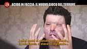 TRINCIA: Acido in faccia: il nuovo gioco del terrore in Inghilterra