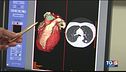 Un unico esame per una diagnosi precoce dei problemi sia di cuore che di polmoni