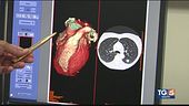 Un unico esame per una diagnosi precoce dei problemi sia di cuore che di polmoni