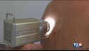 Melanoma, diagnosi e cure