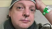 Il comico Dado aggredito dall'ex fidanzato della figlia