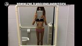 RUGGERI: Anoressia, uomini che vogliono vedere le tue ossa e vederti vomitare