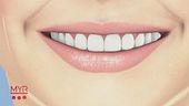 Un sorriso perfetto
