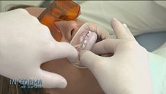 Affrontare l'estate con un sorriso perfetto