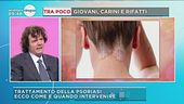 Curare la psoriasi
