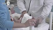 Che cos'è l'ittiosi?