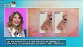 Il ritocchino da selfie