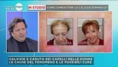 La calvizie femminile