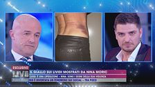 Il giallo sui lividi mostrati da Nina Moric