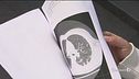 La campagna dei radiologi italiani