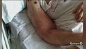 Formiche in ospedale, 17 indagati