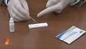 Covid-19: Test anticorpi