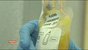 Covid-19: il plasma iperimmune
