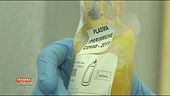 Covid-19: il plasma iperimmune