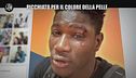 MARTINELLI: Senegalese aggredito a Palermo: "Sono un nero, ma non una merda"